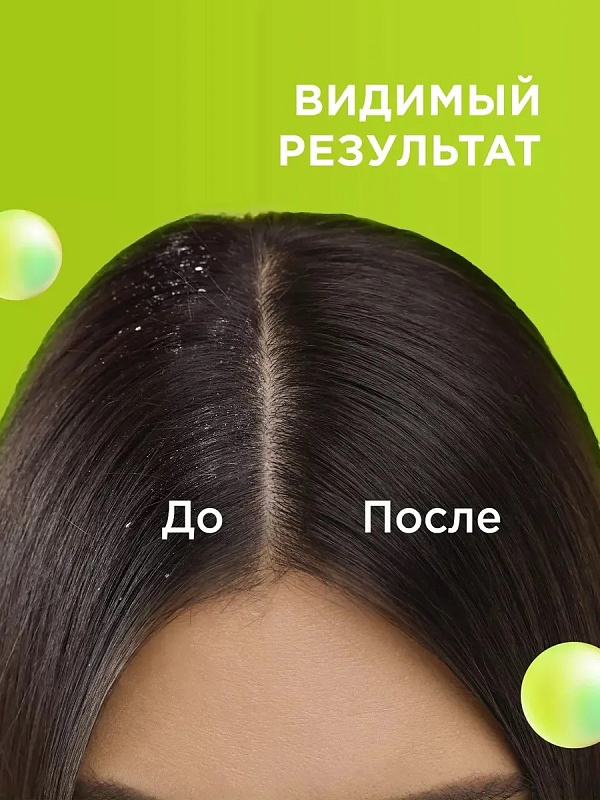 Шампунь и бальзам - ополаскиватель MY MUSE 2 в 1 против перхоти, 400 мл